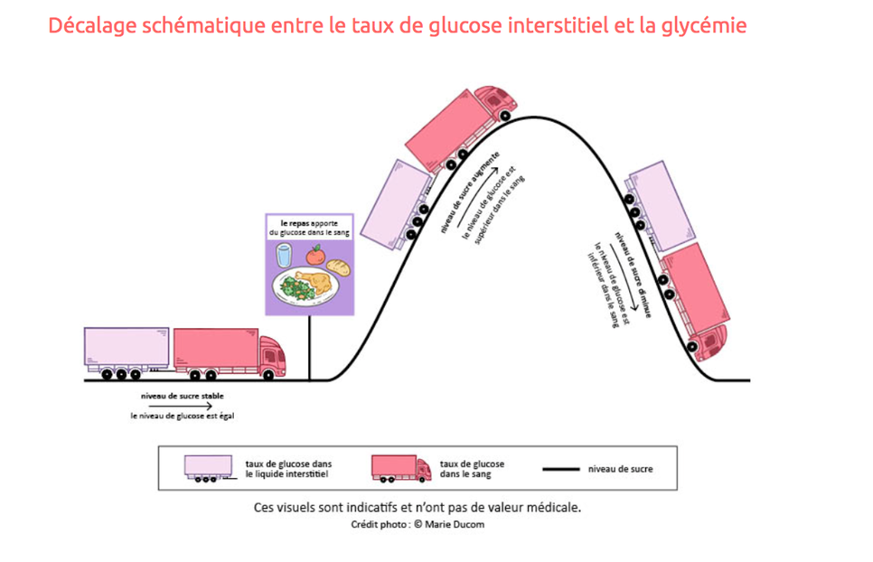 Les Systèmes de Mesure en Continu du Glucose (MCG)